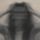 a woman holding her head blurred