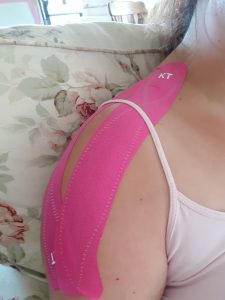 corner of a floral arm chair with my bare shoulder with 2 strips of bright pink sports tape on it