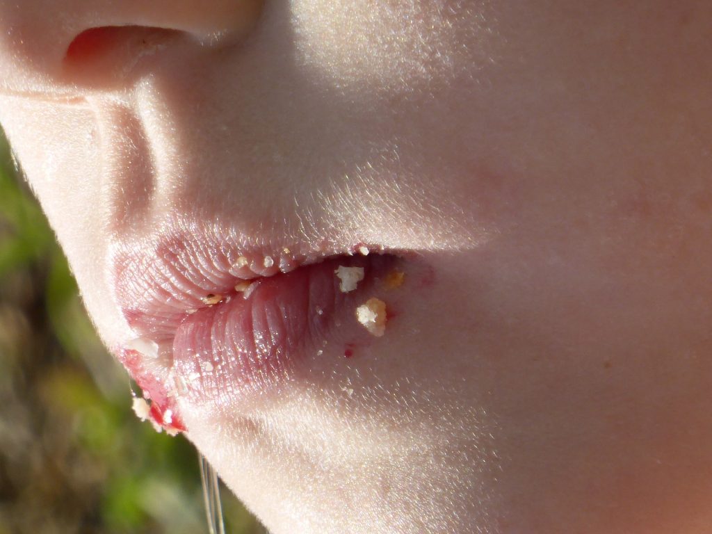 a childs mouth and nose with red lips and crumbs all over them